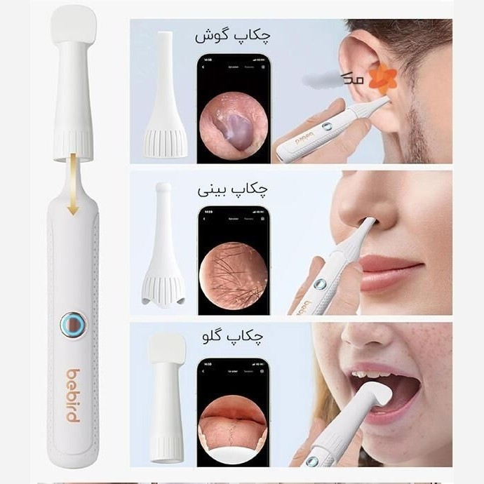 گوش پاک کن شیائومی Bebird مدل R37R جدید قیمت عالی