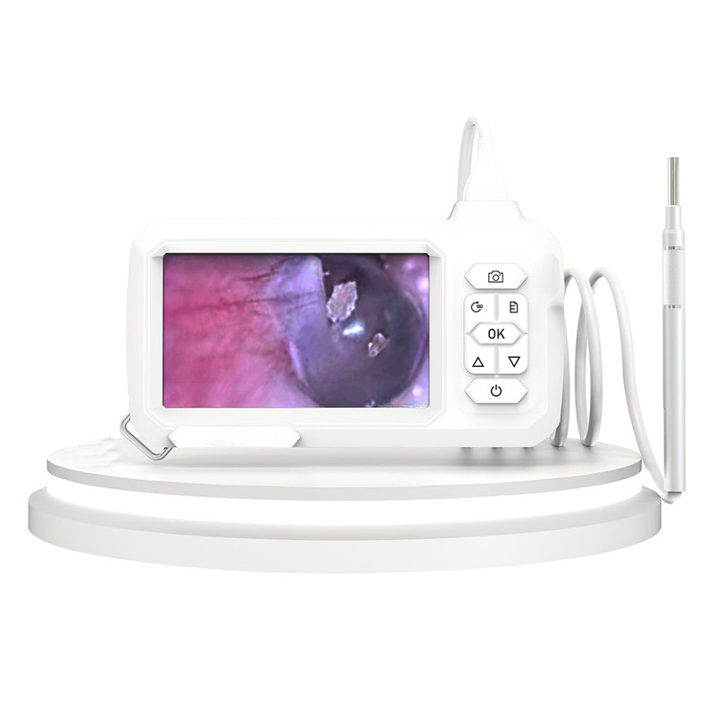 ویدیو اتوسکوپ مدل مانیتور دار کد Visiual Earpick